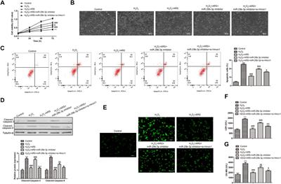 Artemisinin relieves myocardial ischemia-reperfusion injury via modulating miR-29b-3p and hemicentin 1